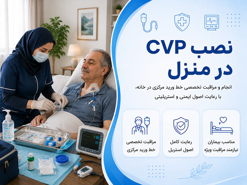 نصب cvp در منزل
