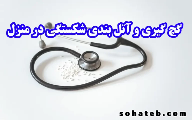 گچ گیری و آتل بندی شکستگی در منزل